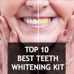 Best and quickest way to get white teeth