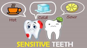 sensitive teeth