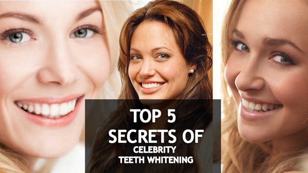 🎥5 Celebrity Teeth Whitening Secrets That Nowhere Will Find